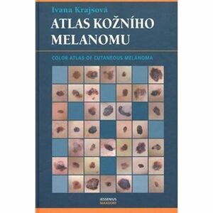 Atlas kožního melanomu