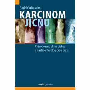 Karcinom jícnu - Průvodce pro chirurgickou a gastroenterologickou praxi