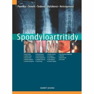 Spondyloartritidy