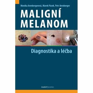 Maligní melanom - Diagnostika a léčba